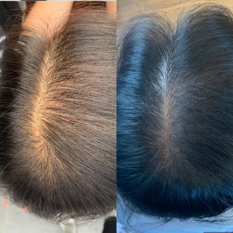 karima.m - Avant / Après