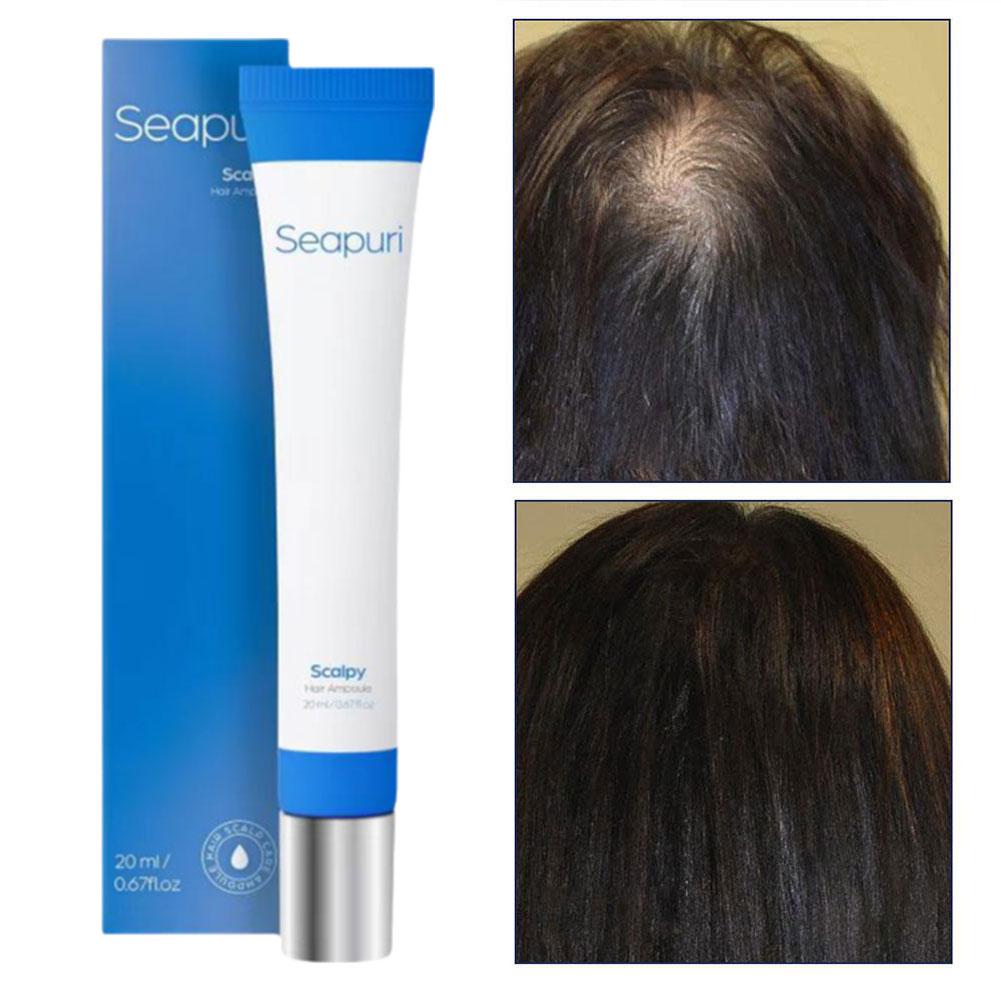 Sérum Activateur de Pousse Capillaire