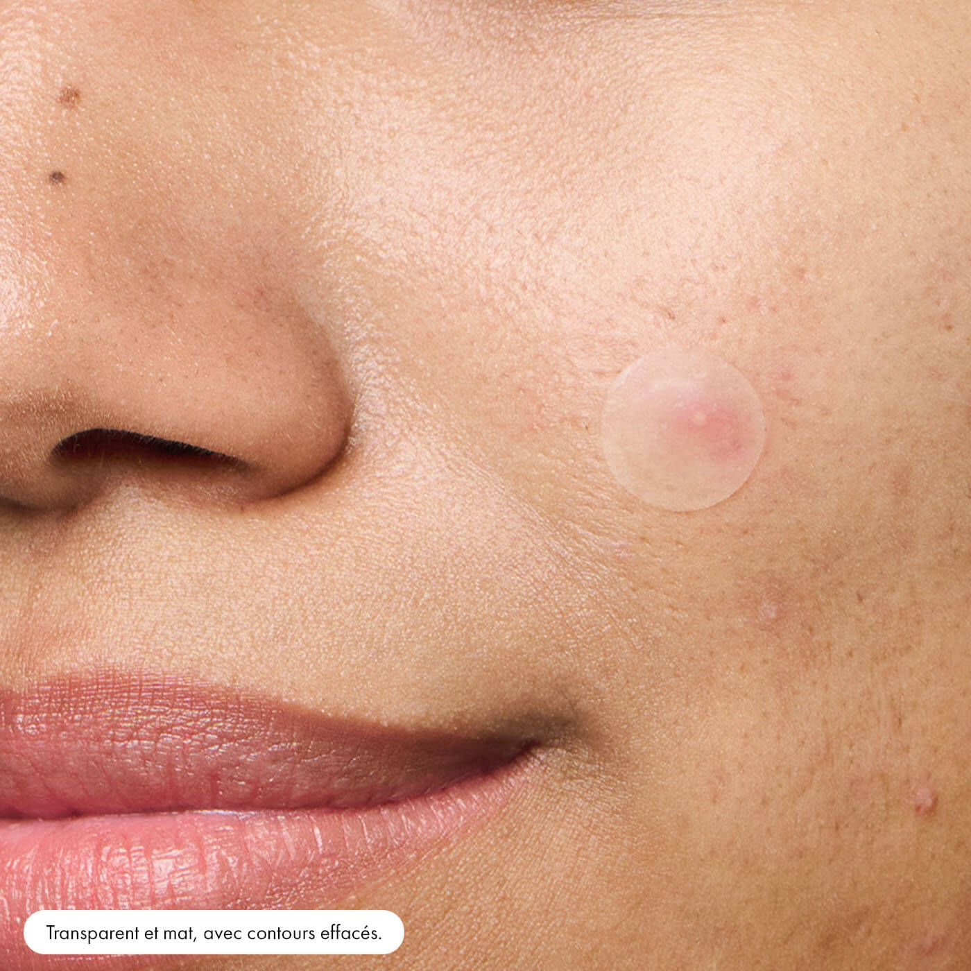 Patch ANTI-ACNÉ  de jour Invisible+ avec technologie hydrocolloïde