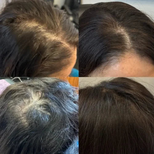 Sophia - Avant / Après